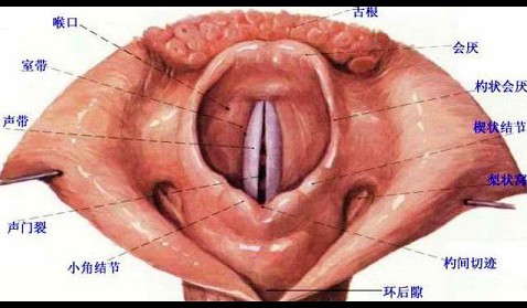 最狭窄的部位在声门裂d,粘膜下血管丰富,易发生水肿e,会厌呈u形或v形