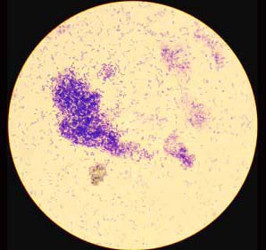 八叠球菌革兰氏染色图片