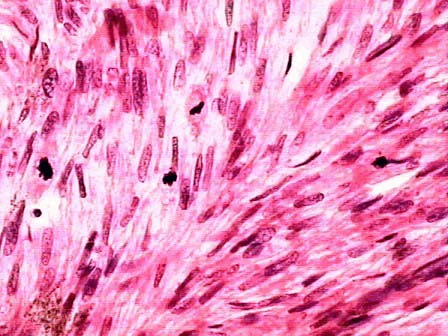 肌纤维镜检图片