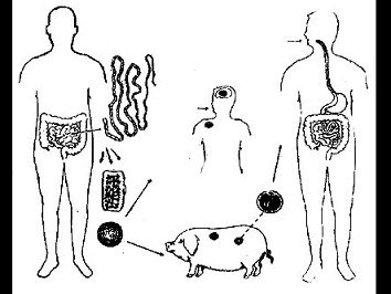如图所示,囊尾蚴病的传染源是 ( )