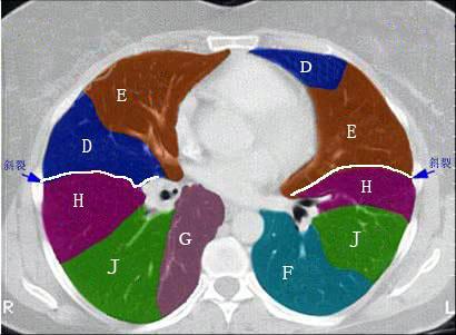 肺下叶的位置图图片